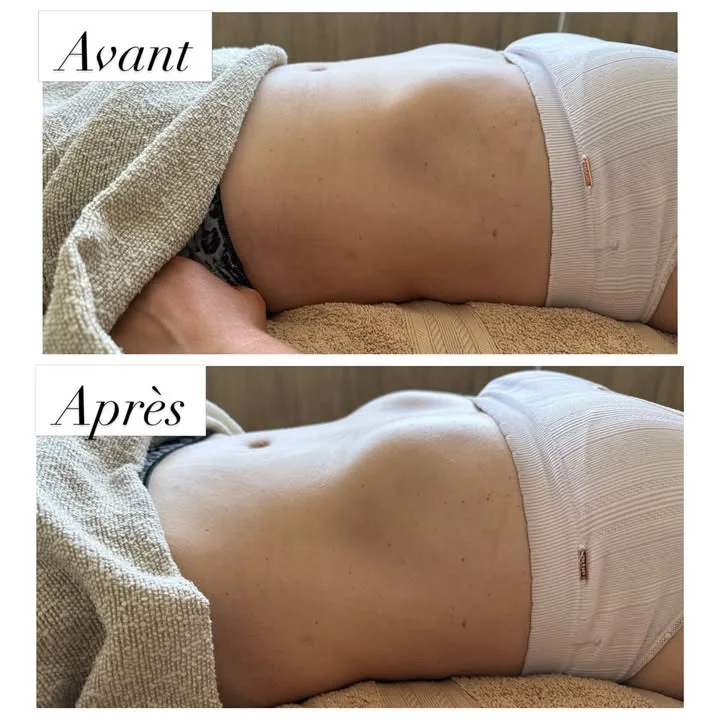 Avant et après une séance de drainage lymphatique